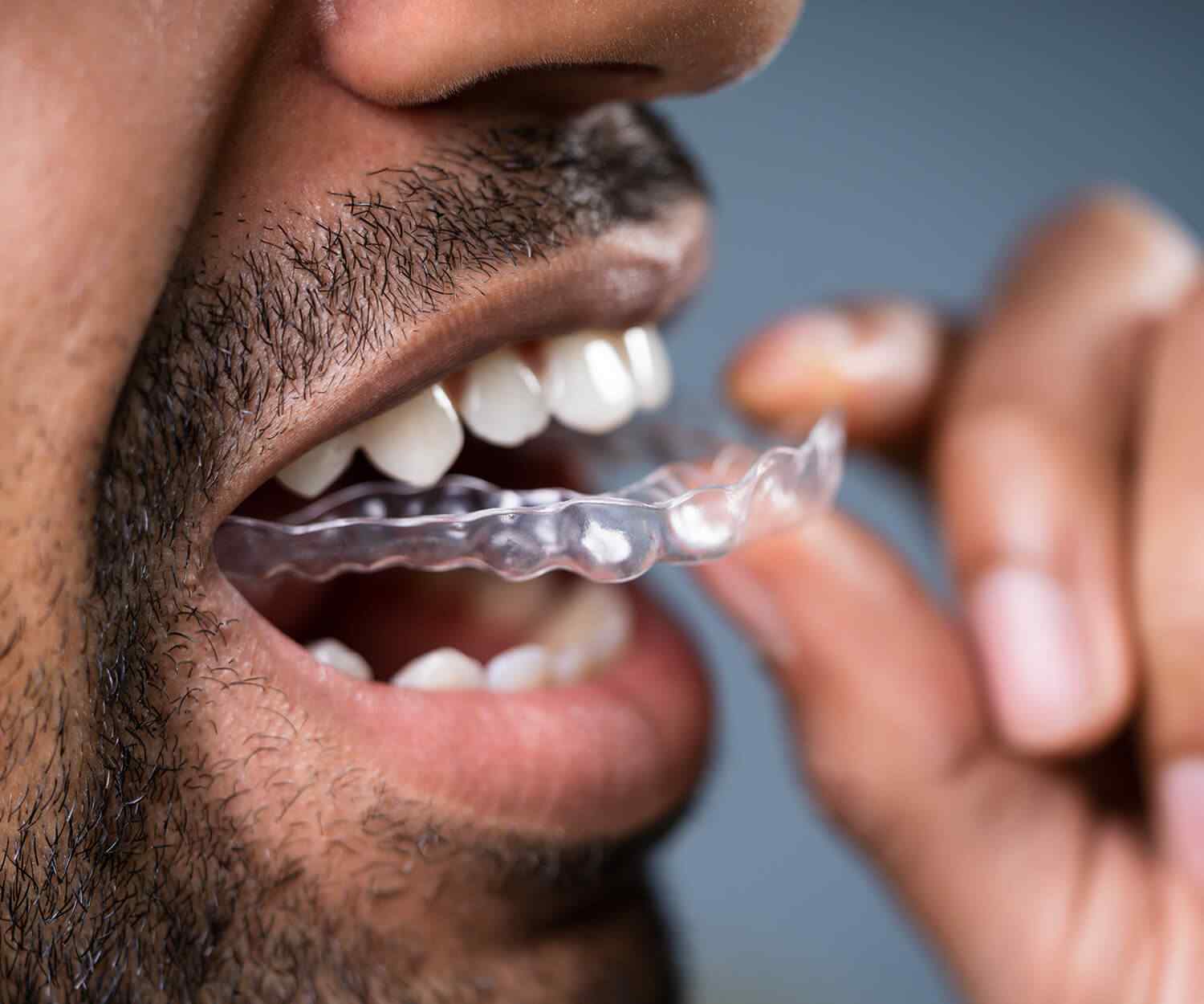 https://www.maxcaremedicalcentre.com.au/wp-content/uploads/2021/10/card_image_home_03-02.jpg